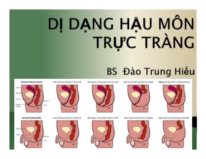 Bài giảng Dị dạng hậu môn trực tràng - Đào Trung Hiếu