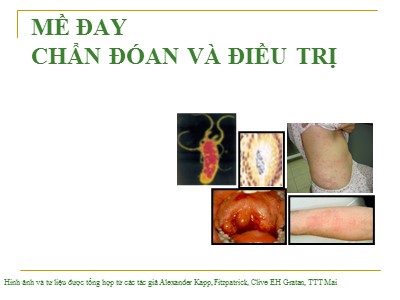 Bài giảng Mề đay - Chẩn đoán và điều trị
