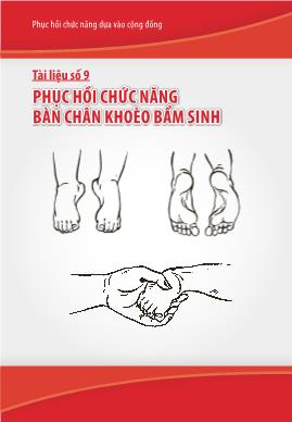 Phục hồi chức năng bàn chân khoèo bẩm sinh